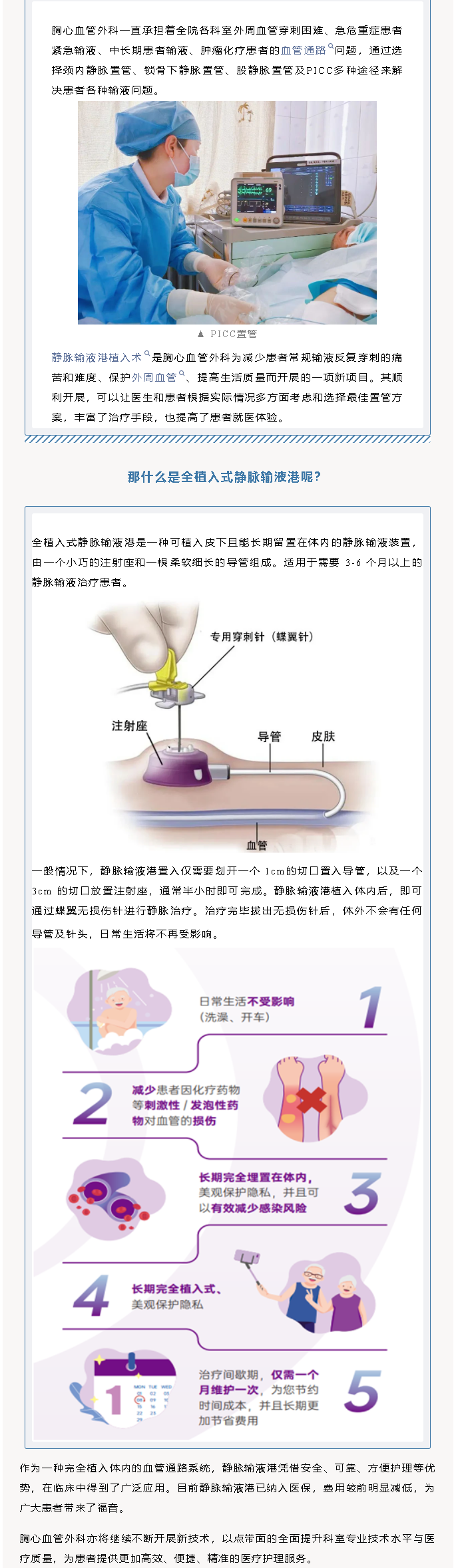 胸心血管外科——全植入式静脉输液港技术(图1)