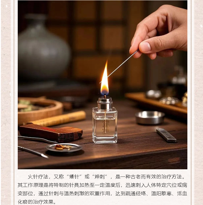 老年病医院（分院）——火针疗法(图1)