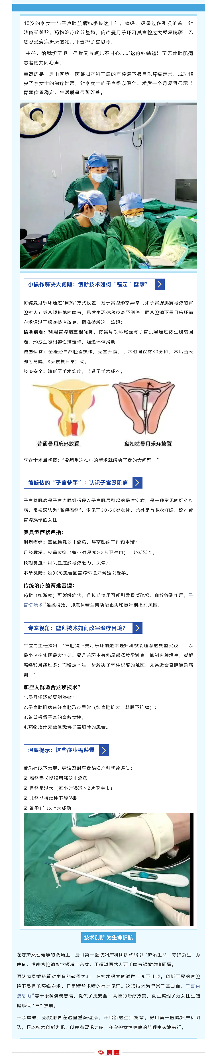 宫腔镜下曼月乐环锚定术为女性保“宫”护航(图1)