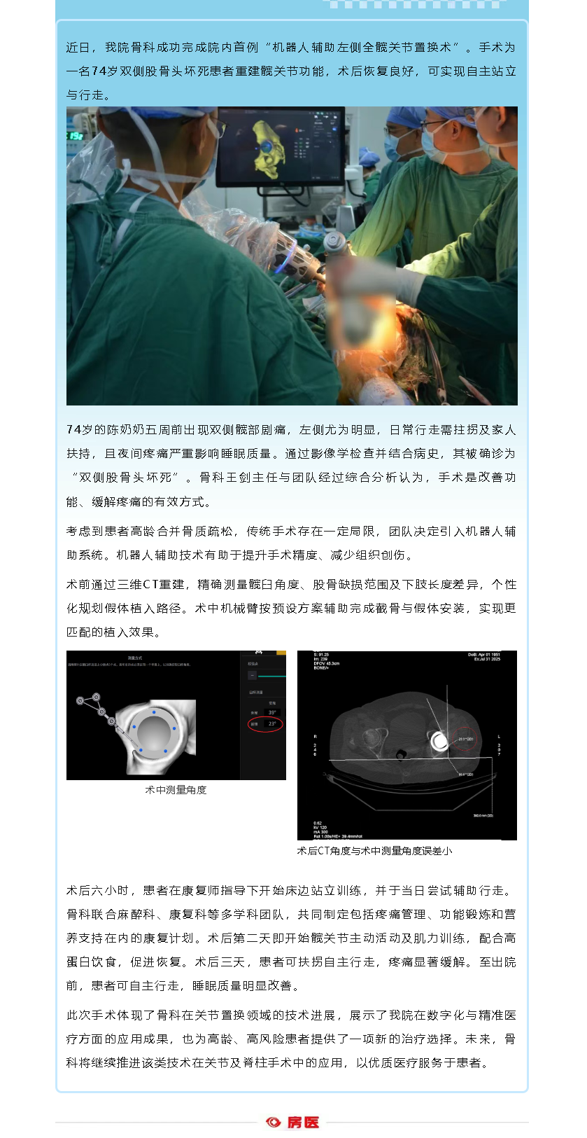 机器人辅助全髋关节置换术助七旬老人重获行走能力(图1)