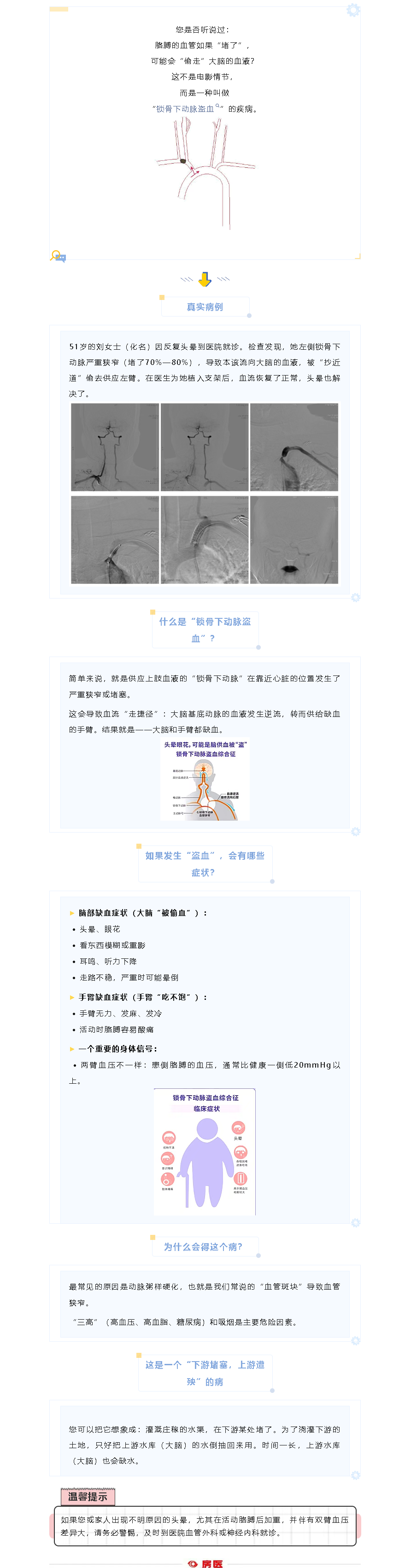 胳膊的血管“堵了”，竟会偷大脑的血？——认识“锁骨下动脉盗血”(图1)