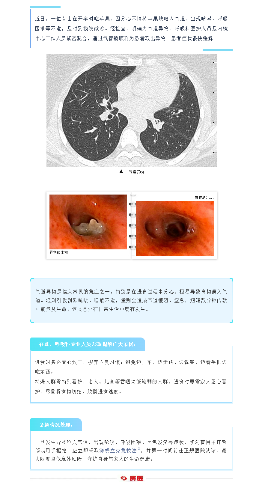 进食别分心，小心异物呛气道(图1)